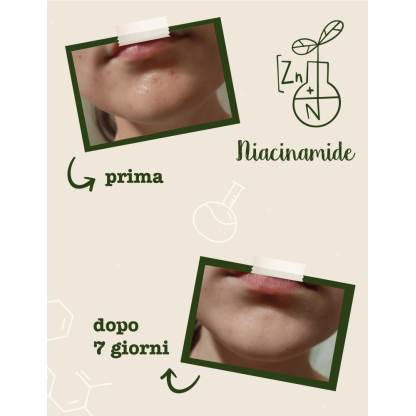Niacinamide + Zinco