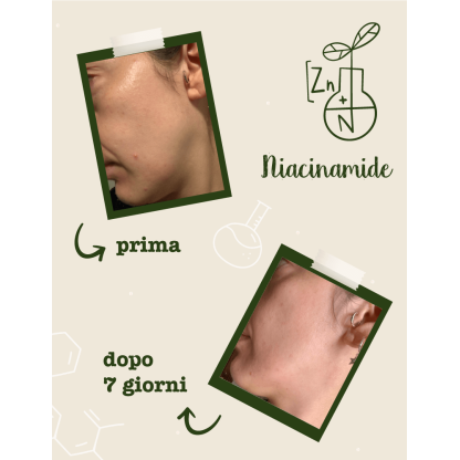Niacinamide + Zinco