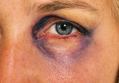 Palette crème pura per lividi - Bruise Crème Pure Palette