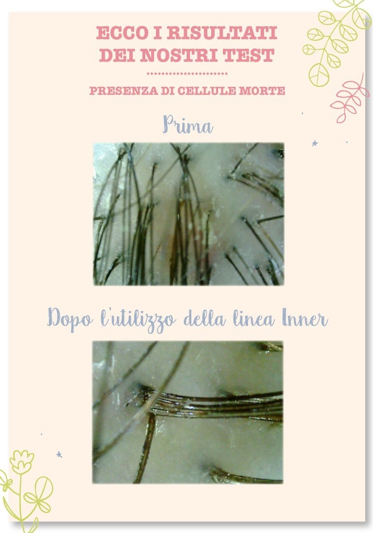 Lozione capelli detox e anti-forfora - Purificante ed Equilibrante
