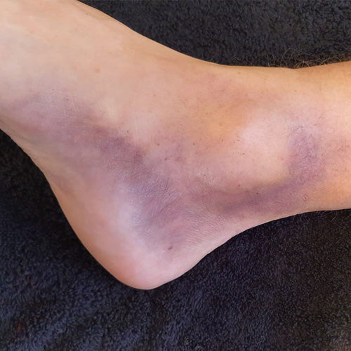 Palette crème pura per lividi - Bruise Crème Pure Palette