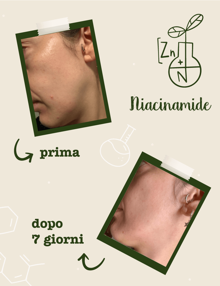 Niacinamide + Zinco Siero Viso Seboregolatore Anti-Imperfezioni