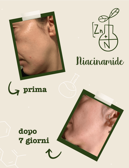 Niacinamide + Zinco Siero Viso Seboregolatore Anti-Imperfezioni
