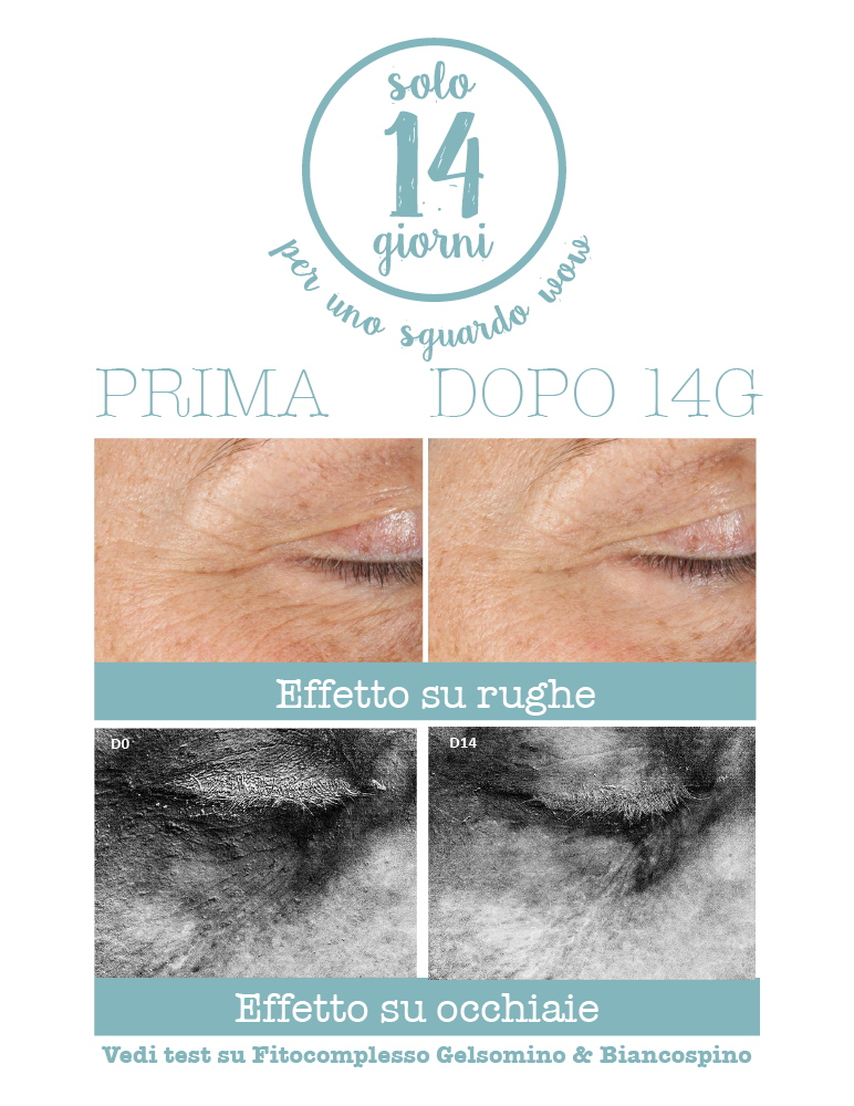 Crema Contorno Occhi 3 in 1 Liftante Antiage WOW - Borse, Rughe, Occhiaie