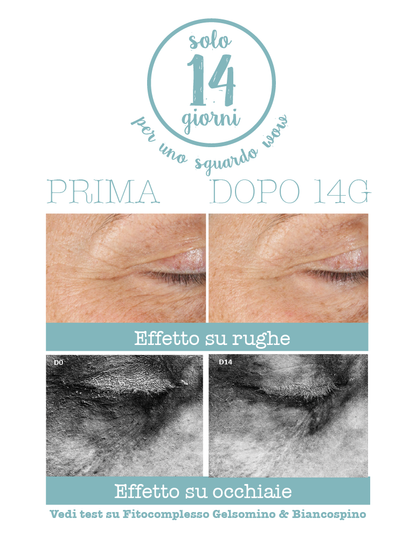Crema Contorno Occhi 3 in 1 Liftante Antiage WOW - Borse, Rughe, Occhiaie